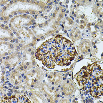 Immunohistochemistry of paraffin-embedded rat kidney using CETP antibody  