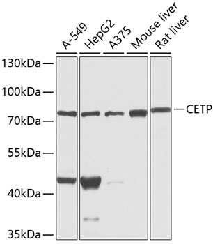 Western blot analysis of extracts of various cell lines, using CETP antibody  at 1:1000 dilution