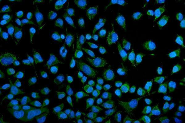 a00310 1 kcnq1 primary antibodies if testing 6
