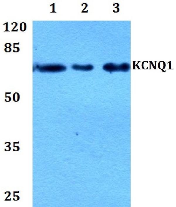 a00310 kcnq1 primary antiboties wb testing 1