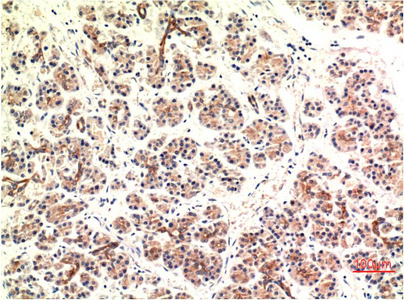 a00311 1 ddit3 primary antibodies ihc testing 1