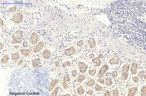 a00311 1 ddit3 primary antibodies ihc testing 3