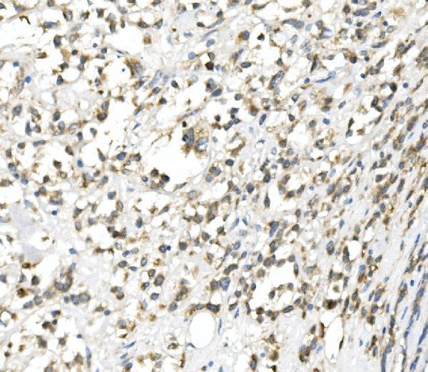 a00311 2 ddit3 primary antibodies ihc testing 2