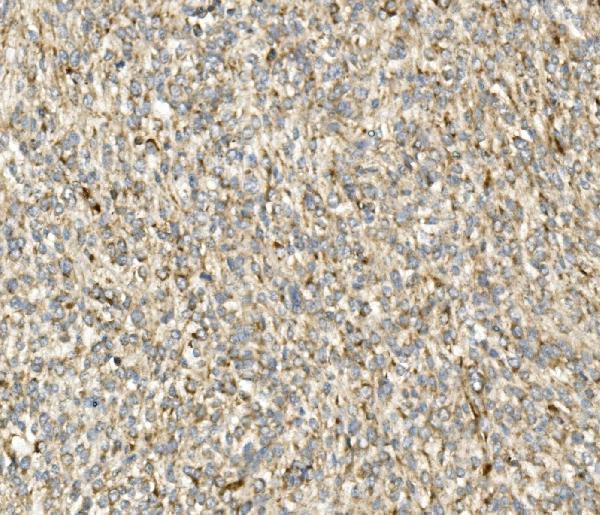 a00311 2 ddit3 primary antibodies ihc testing 3