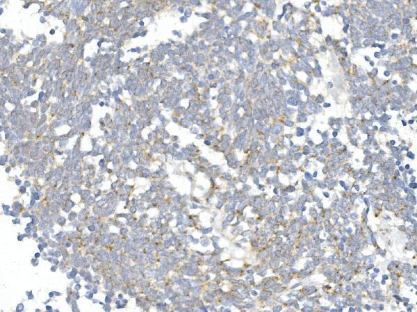 a00311 2 ddit3 primary antibodies ihc testing 4