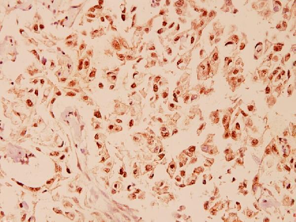 a00311 3 ddit3 primary antiboties ihc testing 2
