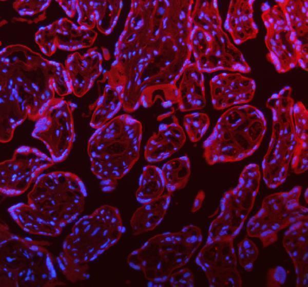 a00312 1 stim1 primary antibodies if testing 11