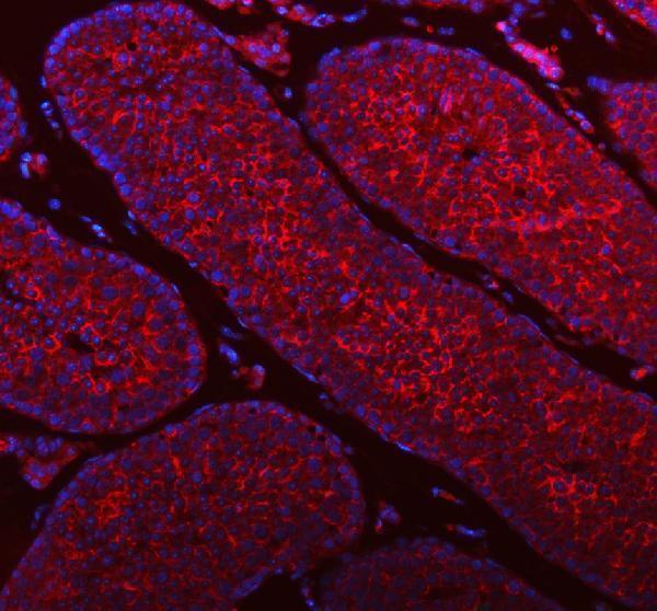 a00312 1 stim1 primary antibodies if testing 12