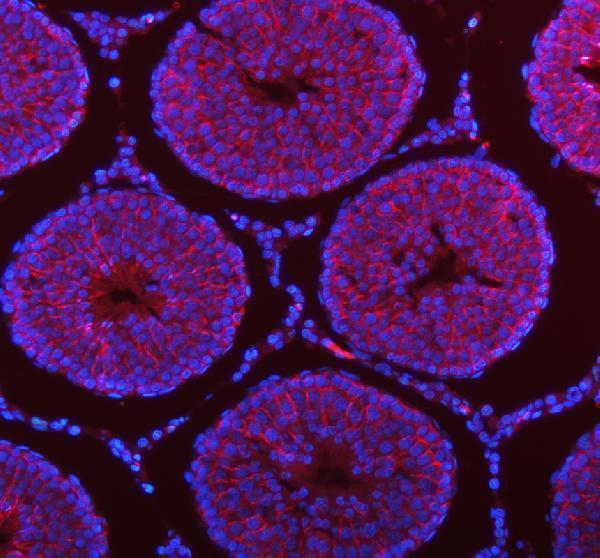 a00312 1 stim1 primary antibodies if testing 13