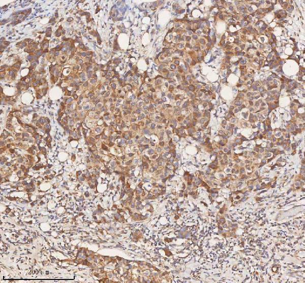  IHC analysis of STIM1 using anti-STIM1 antibody (A00312-1)