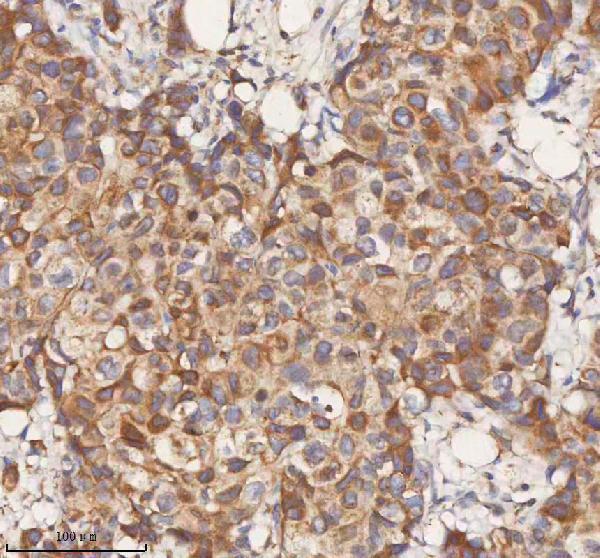  IHC analysis of STIM1 using anti-STIM1 antibody (A00312-1)