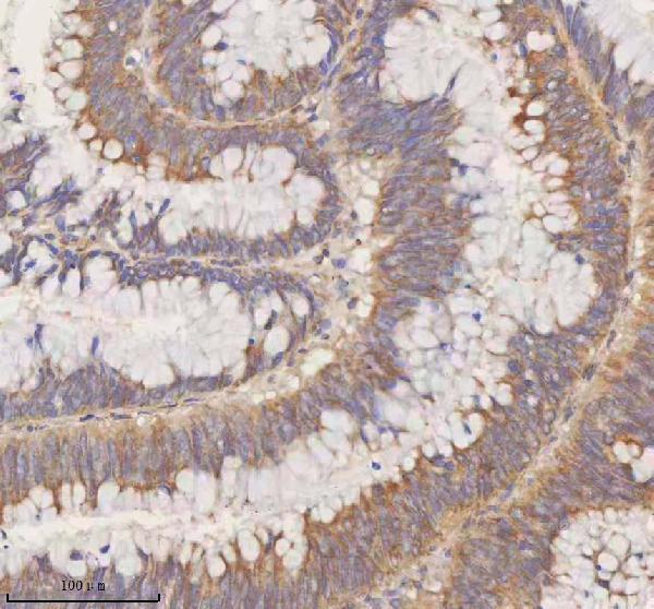 a00312 1 stim1 primary antibodies ihc testing 4
