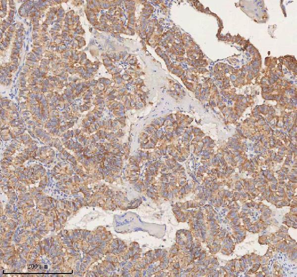 a00312 1 stim1 primary antibodies ihc testing 6