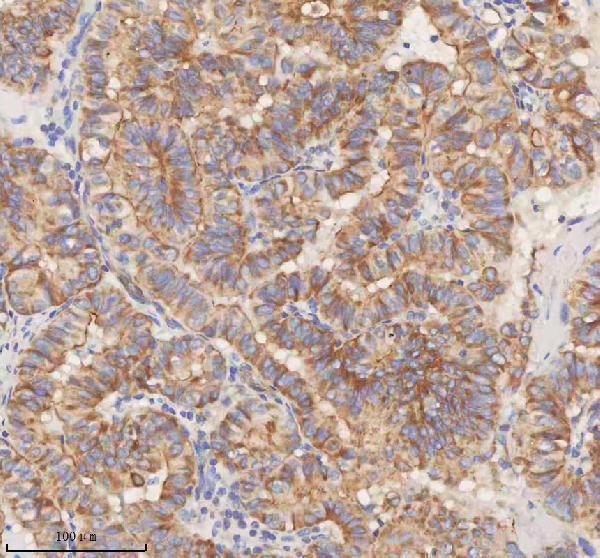 a00312 1 stim1 primary antibodies ihc testing 7