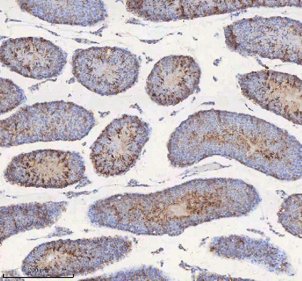 a00312 1 stim1 primary antibodies ihc testing 8