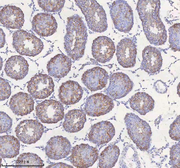 a00312 1 stim1 primary antibodies ihc testing 9