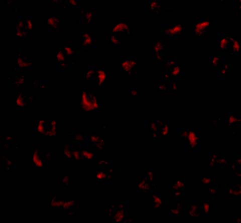 a00313 bmi1 primary antibodies if testing 3