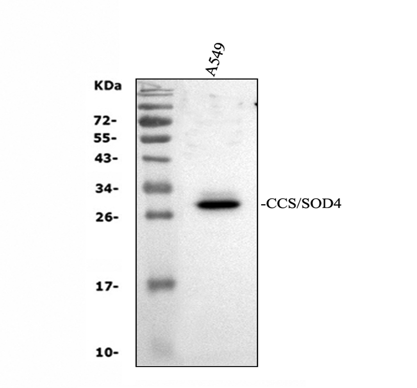 Western blot analysis of CCS using anti-CCS antibody (A00314-1)