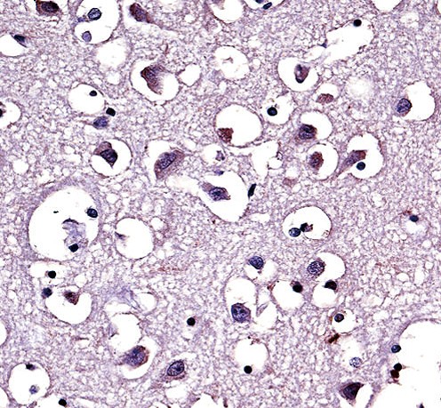 a00316 1 anti lpl antibody center ihc p testing 3