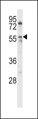a00316 1 anti lpl antibody center wb testing 1