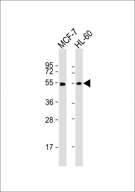 a00316 1 anti lpl antibody center wb testing 2