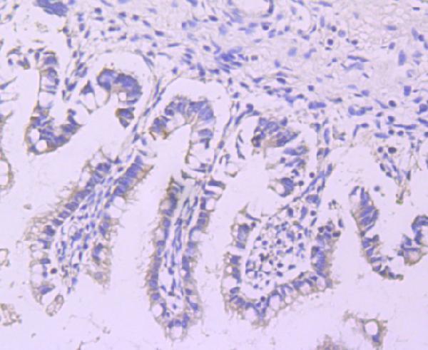 Immunohistochemical analysis of paraffin-embedded human ileum tissue using anti-Lipoprotein lipase antibody