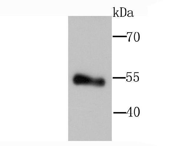 Western blot analysis of Lipoprotein lipase on human placenta tissue lysate using anti-Lipoprotein lipase antibody at 1/1,000 dilution