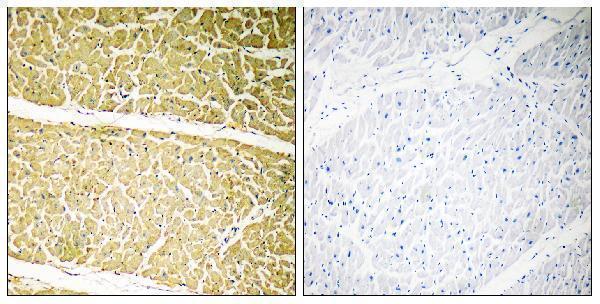 Immunohistochemistryt analysis of paraffin-embedded human heart, using C6 Antibody