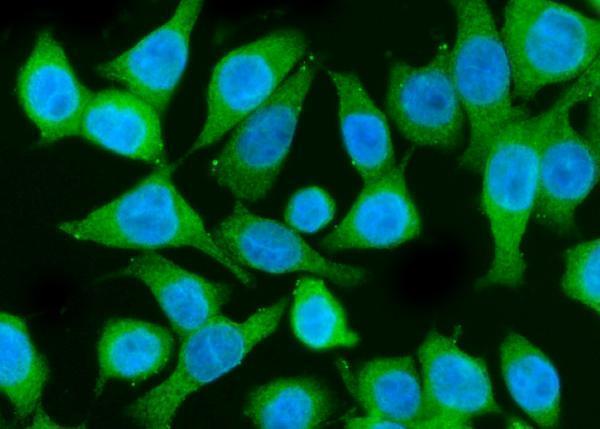 a00318 1 pik3 primary antibodies if testing 7