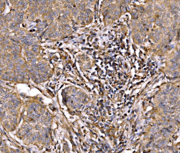 a00318 1 pik3 primary antibodies ihc testing 2