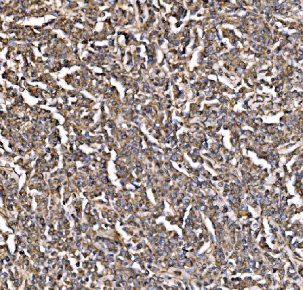 a00318 1 pik3 primary antibodies ihc testing 3