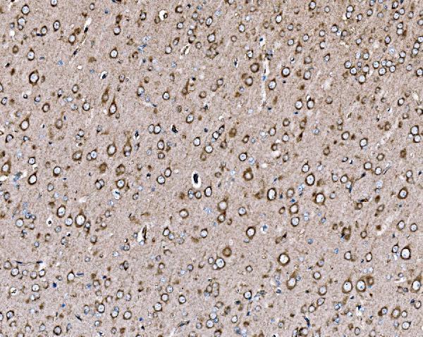 a00318 1 pik3 primary antibodies ihc testing 6