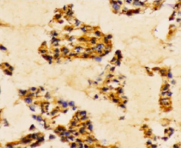 a00318y467 pik3r1 primary antiboties ihc testing 2