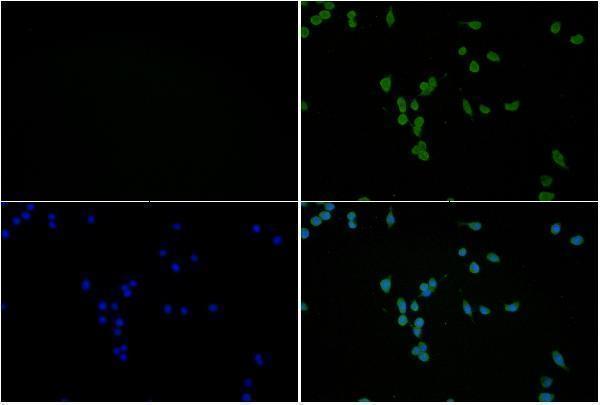 a00318y607 pik3r1 primary antiboties if testing 2