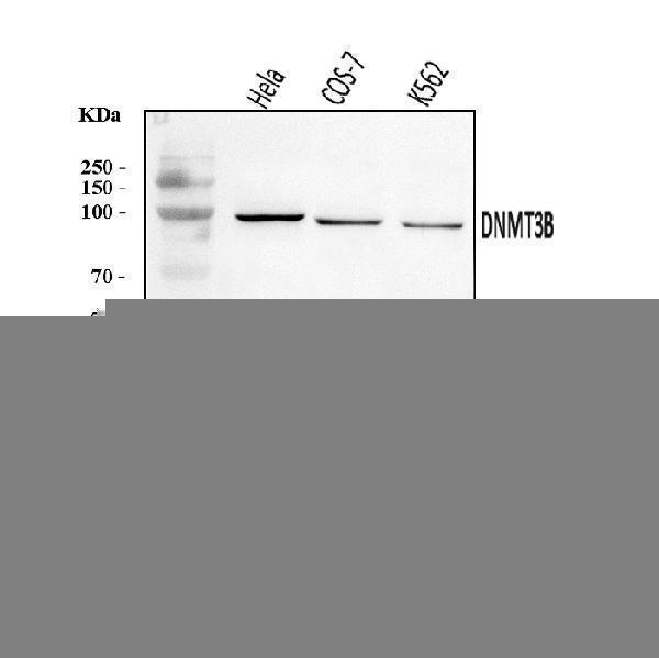  Western blot analysis of DNMT3B using anti-DNMT3B antibody (A00319-2)