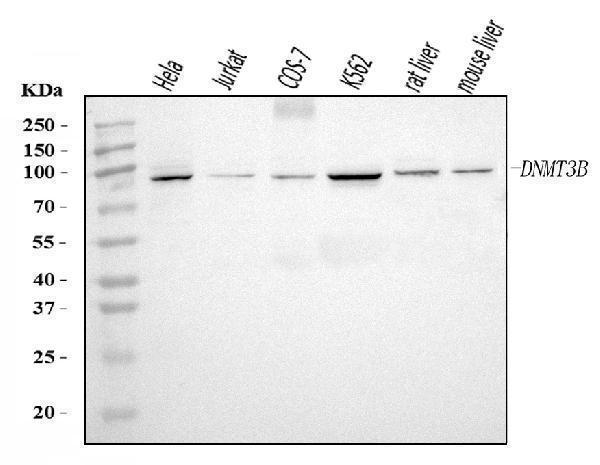  Western blot analysis of DNMT3B using anti-DNMT3B antibody (A00319-3)