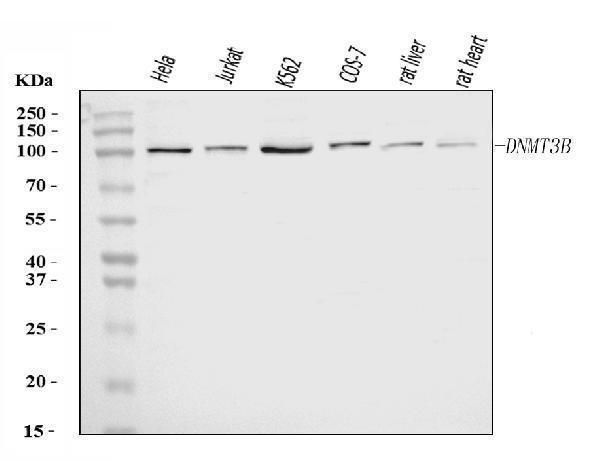  Western blot analysis of DNMT3B using anti-DNMT3B antibody (A00319-4)
