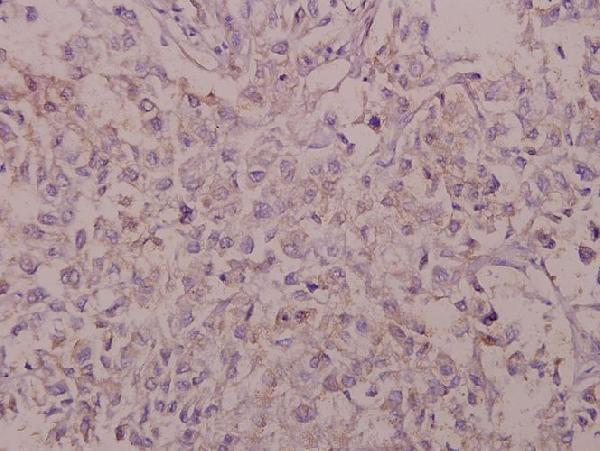 a00322 1 bace1 primary antiboties ihc testing 2
