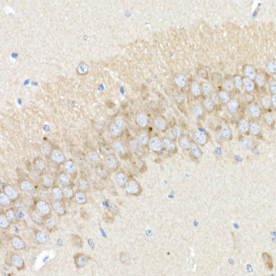 Immunohistochemistry of paraffin-embedded mouse hippocampus using BACE1 Rabbit pAb  at dilution of 1:25 