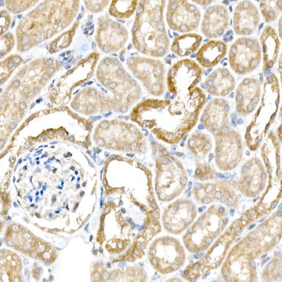 Immunohistochemistry of paraffin-embedded mouse kidney using BACE1 Rabbit pAb  at dilution of 1:25 