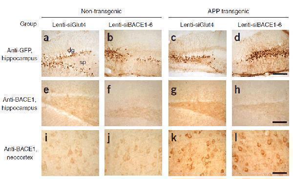a00322 bace1 primary antibodies ihc testing 7