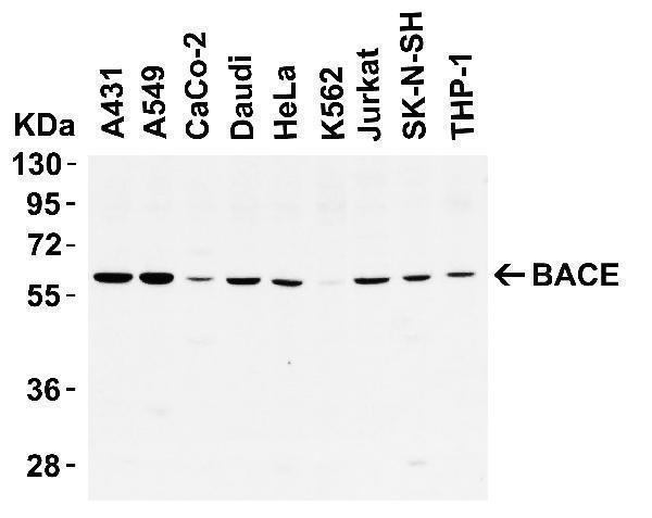 a00322 bace1 primary antibodies wb testing 1