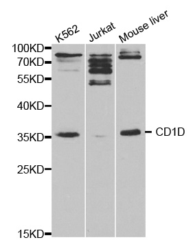 Western blot analysis of CD1D polyclonal antibody