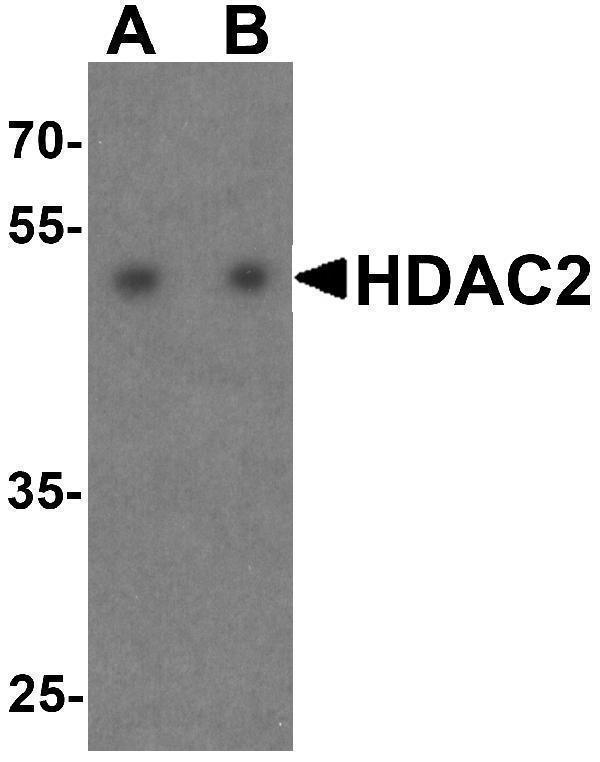 Western blot analysis of HDAC2 in HeLa cell lysate with HDAC2 antibody at (A) 0
