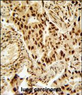 a00325 2 anti hdac2 antibody center ihc p testing 3