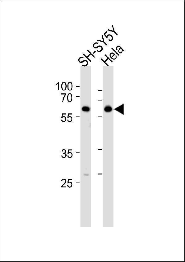 a00325 2 anti hdac2 antibody center wb testing 2
