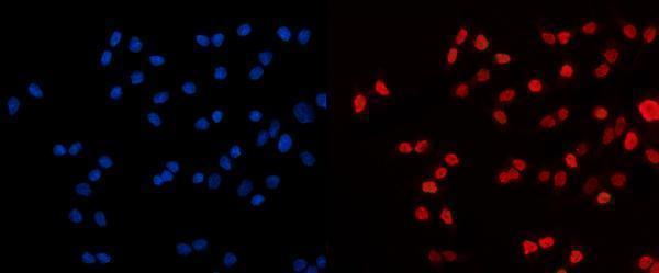  IF analysis of HDAC2 using anti-HDAC2 antibody (A00325-3)
