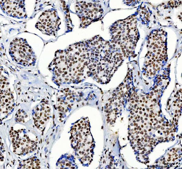 IHC analysis of HDAC2 using anti-HDAC2 antibody (A00325-3)