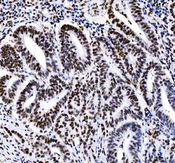 a00325 3 hdac2 primary antibodies ihc testing 2_1