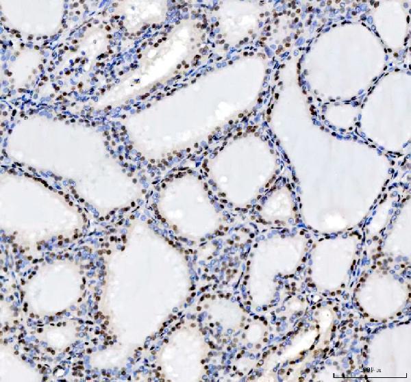 a00325 3 hdac2 primary antibodies ihc testing 3_1